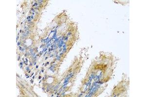 Immunohistochemistry of paraffin-embedded Human trachea using COX6B1 Polyclonal Antibody at dilution of 1:100 (40x lens). (COX6B1 antibody)