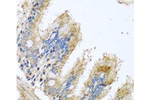 Immunohistochemistry of paraffin-embedded Human trachea using COX6B1 Polyclonal Antibody at dilution of 1:100 (40x lens).