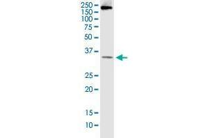 Western Blotting (WB) image for anti-B-Cell CLL/lymphoma 7B (BCL7B) (AA 124-202) antibody (ABIN564007)