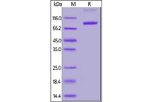 Fed Human ROR1, Fc Tag on  under reducing (R) condition. (ROR1 Protein (AA 30-403) (Fc Tag,FITC))