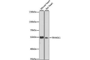 Western blot analysis of extracts of various cell lines, using TINAGL1 antibody (ABIN6293721) at 1:3000 dilution. (TINAGL1 antibody)