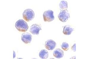 Immunocytochemistry of STAT1 alpha in HeLa cells with this product at 10 μg/ml. (STAT1 antibody  (C-Term))
