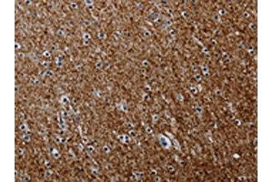 The image on the left is immunohistochemistry of paraffin-embedded Human brain tissue using ABIN7191804(PCDHAC1 Antibody) at dilution 1/50, on the right is treated with synthetic peptide. (PCDHAC1 antibody)