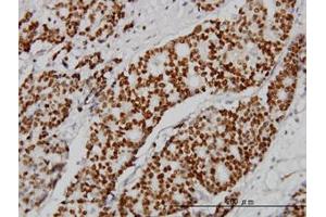 Image no. 1 for anti-Progesterone Receptor (PGR) (AA 1-111) antibody (ABIN598872) (Progesterone Receptor antibody  (AA 1-111))