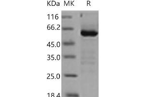 Western Blotting (WB) image for 5'-Nucleotidase, Ecto (CD73) (NT5E) (Active) protein (His tag) (ABIN7194081)