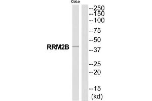 Western Blotting (WB) image for anti-Ribonucleotide Reductase M2 B (TP53 Inducible) (RRM2B) (Internal Region) antibody (ABIN1852784) (RRM2B antibody  (Internal Region))