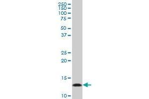 PHF5A polyclonal antibody (A01), Lot # 051005JC01. (PHF5A antibody  (AA 1-110))