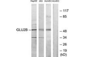 Western blot analysis of extracts from HepG2/293/HuvEC cells, using GLU2B Antibody.