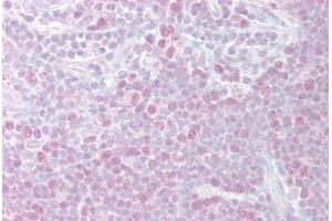 Anti-MCM3 antibody IHC staining of human thymus. (MCM3 antibody  (AA 726-775))
