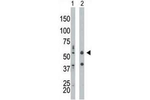 PKR antibody used in western blot to detect PRKR/PKR in mouse liver tissue lysate (Lane 1) and HepG2 cell lysate (2). (EIF2AK2 antibody  (AA 11-42))