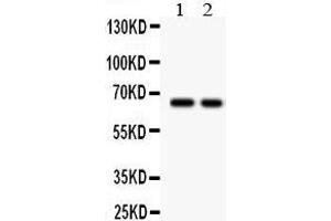 Lane 2: COLO320 Whole Cell Lysate at 40ug Predicted bind size: 65KD Observed bind size: 65KD (TGFBR2 antibody  (Middle Region))