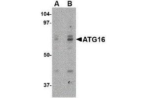 Western Blotting (WB) image for anti-ATG16 Autophagy Related 16-Like 1 (ATG16L1) (Internal Region) antibody (ABIN2477528) (ATG16L1 antibody  (Internal Region))