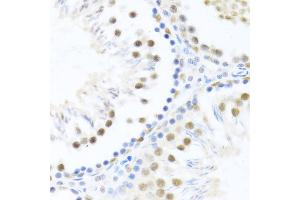 Immunohistochemistry of paraffin-embedded rat testis using DDX46 antibody  at dilution of 1:100 (40x lens).