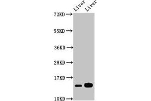 Western Blot Positive WB detected in: Mouse liver tissue, Rat liver tissue All lanes: HIST1H2BB antibody at 2. (HIST1H2BB antibody  (AA 2-126))