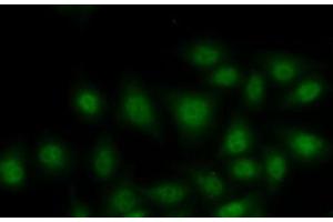 Immunofluorescence analysis of MCF7 cells using RORA Polyclonal Antibody (RORA antibody)