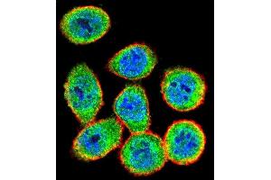 Confocal immunofluorescent analysis of IKK beta Antibody (ABIN1882097 and ABIN2842182) with Hela cell followed by Alexa Fluor 488-conjugated goat anti-rabbit lgG (green). (IKBKB antibody)