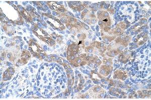 Human kidney (Melanoma gp100 antibody  (N-Term))