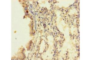 Immunohistochemistry of paraffin-embedded human lung tissue using ABIN7173528 at dilution of 1:100 (DUS4L antibody  (AA 1-196))