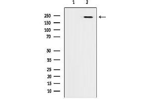 anti-ADAM Metallopeptidase with thrombospondin Type 1 Motif, 9 (ADAMTS9) (N-Term) antibody