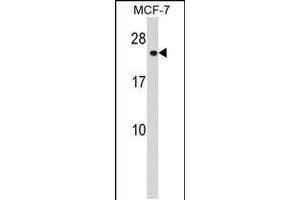 Western blot analysis in MCF-7 cell line lysates (35ug/lane). (CHMP1A antibody  (N-Term))
