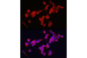 Immunofluorescence analysis of SH-SY5Y cells using KIF5A Rabbit pAb (ABIN1680589, ABIN3017664, ABIN3017665 and ABIN6220202) at dilution of 1:250 (40x lens). (KIF5A antibody  (AA 933-1032))