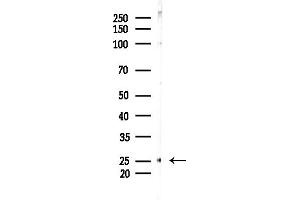 anti-Chemokine-Like Factor (CKLF) (C-Term) antibody