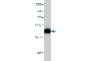 Western Blotting (WB) image for anti-Suppressor of Cytokine Signaling 5 (SOCS5) (AA 1-110) antibody (ABIN564173)