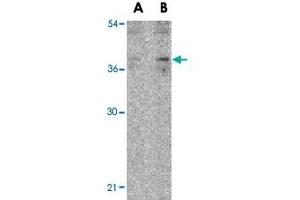 Western blot analysis of IL27 in EL4 lysate with IL27 polyclonal antibody  at (A) 2 and (B) 4 ug/mL . (IL-27 antibody  (N-Term))