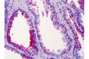 Human Prostate: Formalin-Fixed, Paraffin-Embedded (FFPE) (ST14 antibody  (N-Term))