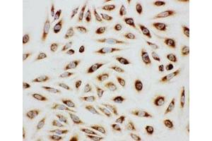 Immunocytochemistry (ICC) image for anti-Paxillin (PXN) (AA 456-472) antibody (ABIN3032168)