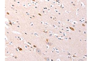 The image on the left is immunohistochemistry of paraffin-embedded Human brain tissue using ABIN7192139(RalA Antibody) at dilution 1/20, on the right is treated with synthetic peptide. (rala antibody)