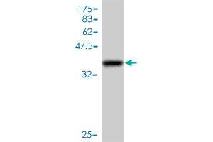 Western Blot detection against Immunogen (37. (ATR antibody  (AA 2545-2644))