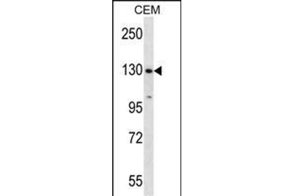 SF3B1 antibody  (N-Term)