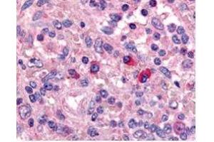 Affinity Purified anti-Artemis antibody was used at a 1:1000 dilution to detect Artemis by immunohistochemistry in human spleen. (DCLRE1C antibody  (AA 482-495))