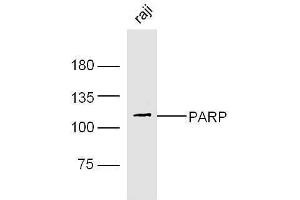 Western Blotting (WB) image for anti-Poly (ADP-Ribose) Polymerase 1 (PARP1) (AA 201-300) antibody (ABIN677903)