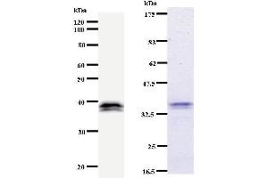 Left: IRF3 staining. (IRF3 antibody)