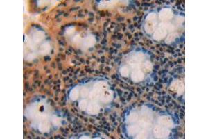 IHC-P analysis of rectum tissue, with DAB staining. (SBEM antibody  (AA 21-90))