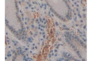 Detection of ENPEP in Human Stomach Tissue using Polyclonal Antibody to Aminopeptidase A (ENPEP) (ENPEP antibody  (AA 718-948))