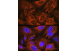 Immunofluorescence analysis of U-2 OS cells using MSMB Rabbit mAb (ABIN1681107, ABIN3018643, ABIN3018644 and ABIN7101636) at dilution of 1:100 (40x lens). (MSMB antibody)
