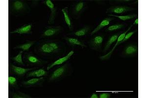 Immunofluorescence (IF) image for anti-V-Crk Sarcoma Virus CT10 Oncogene Homolog (Avian) (CRK) (AA 1-204) antibody (ABIN514602)