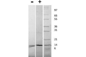 SDS-PAGE of Mouse Nerve Growth Factor beta Recombinant Protein SDS-PAGE of Mouse Nerve Growth Factor beta Recombinant Protein. (NGFB Protein)