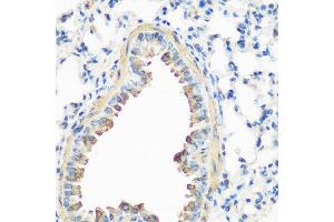 Immunohistochemistry of paraffin-embedded mouse lung using CAV3 antibody at dilution of 1:200 (40x lens). (Caveolin 3 antibody)