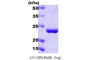 Figure annotation denotes ug of protein loaded and % gel used. (PSMD10 Protein (AA 1-226))