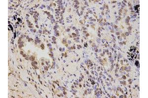 Immunohistochemistry (IHC) image for anti-Proteasome (Prosome, Macropain) 26S Subunit, Non-ATPase, 2 (PSMD2) antibody (ABIN1874389) (PSMD2 antibody)