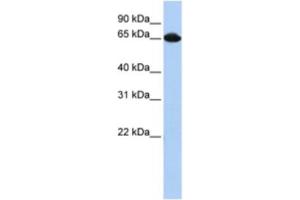 Western Blotting (WB) image for anti-Small Nuclear Ribonucleoprotein 70kDa (U1) (SNRNP70) antibody (ABIN2462137) (SNRNP70 antibody)