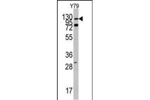 Western blot analysis of ABL1 Antibody (N-term ) (ABIN392079 and ABIN2841839) in Y79 cell line lysates (35 μg/lane). (ABL1 antibody  (N-Term))