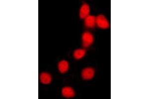 Immunofluorescent analysis of Histone H2B staining in HeLa cells. (Histone H2B antibody  (N-Term))