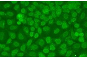 Immunofluorescence analysis of A549 cells using TARBP2 Polyclonal Antibody (TARBP2 antibody)