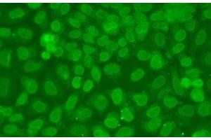 Immunofluorescence analysis of A549 cells using TARBP2 Polyclonal Antibody (TARBP2 antibody)
