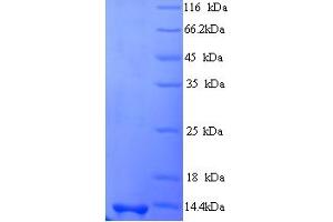 SDS-PAGE (SDS) image for Stimulator of Chondrogenesis 1 (SCRG1) (AA 21-98) protein (His tag) (ABIN5714302)